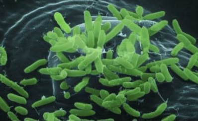 Vi khuẩn P.aeruginosa